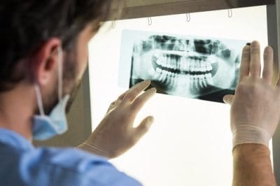 What Do Dental X-Rays Show?