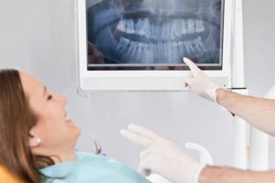 Your Guide to Becoming a Dental X-Rays Know-it-All
