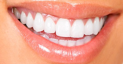 Teeth Whitening