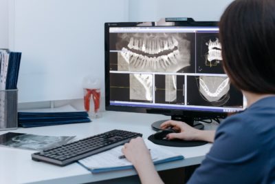 How Much Radiation Is In Dental X-Rays?