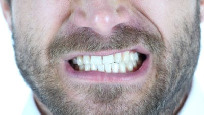 What Are Signs That I Grind My Teeth?