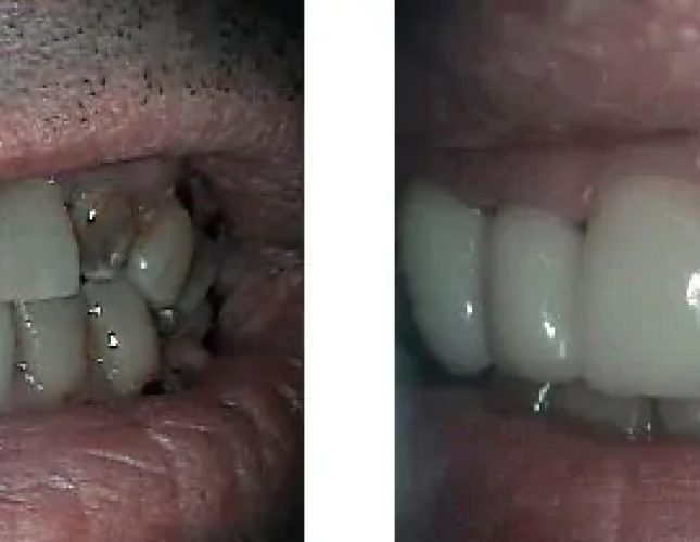 Smile Gallery 1