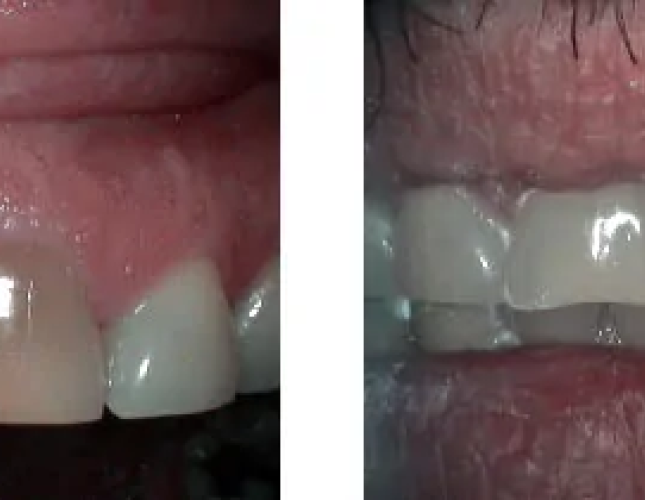 Smile Gallery 2