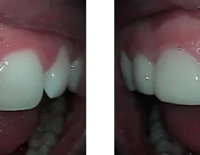 Smile Gallery 3