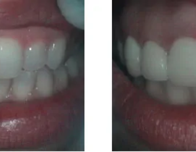 Smile Gallery 6