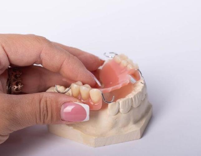 Cost Considerations: Understanding the Financial Aspects of Dental Bridges