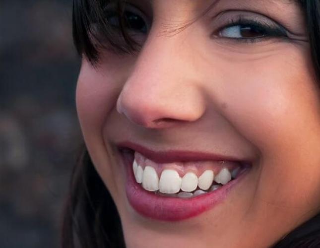 Gummy Smile Treatment: Everything You Need to Know